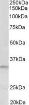 Peptidase Inhibitor 15 antibody, PA5-37944, Invitrogen Antibodies, Western Blot image 