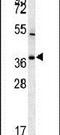 TNFAIP3 Interacting Protein 3 antibody, PA5-25510, Invitrogen Antibodies, Western Blot image 