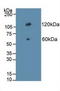 Cadherin 17 antibody, LS-C372855, Lifespan Biosciences, Western Blot image 