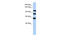 Protein Phosphatase 1 Regulatory Subunit 13B antibody, 26-267, ProSci, Western Blot image 