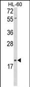 Delta Like Non-Canonical Notch Ligand 2 antibody, PA5-72612, Invitrogen Antibodies, Western Blot image 