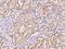 Adenosine Deaminase TRNA Specific 1 antibody, 203089-T08, Sino Biological, Immunohistochemistry paraffin image 