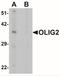 Oligodendrocyte Transcription Factor 2 antibody, NBP2-41269, Novus Biologicals, Western Blot image 