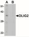 Oligodendrocyte transcription factor 2 antibody, NBP2-41269, Novus Biologicals, Western Blot image 