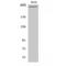 Coagulation Factor VIII antibody, LS-C383439, Lifespan Biosciences, Western Blot image 