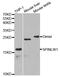 Epididymal Peptidase Inhibitor antibody, MBS9413107, MyBioSource, Western Blot image 