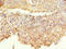 Coronin 1C antibody, LS-C675575, Lifespan Biosciences, Immunohistochemistry paraffin image 