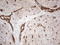 Ectonucleoside Triphosphate Diphosphohydrolase 1 antibody, LS-C790307, Lifespan Biosciences, Immunohistochemistry paraffin image 