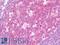 Interleukin 17 Receptor E antibody, LS-B10072, Lifespan Biosciences, Immunohistochemistry frozen image 