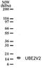 Ubiquitin Conjugating Enzyme E2 V2 antibody, NB100-56360, Novus Biologicals, Western Blot image 