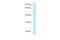 Histidyl-TRNA Synthetase 2, Mitochondrial antibody, A07330, Boster Biological Technology, Western Blot image 