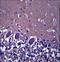 Abhydrolase Domain Containing 4 antibody, LS-C155874, Lifespan Biosciences, Immunohistochemistry paraffin image 