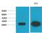 Galectin 3 antibody, GTX34031, GeneTex, Western Blot image 