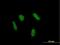 Zinc Finger Protein 436 antibody, H00080818-B01P, Novus Biologicals, Immunofluorescence image 