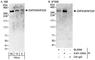 Zinc Finger Protein 638 antibody, A301-547A, Bethyl Labs, Immunoprecipitation image 