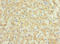 Interleukin 17 Receptor B antibody, LS-C675887, Lifespan Biosciences, Immunohistochemistry paraffin image 