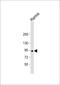 Nuclear GTPase, Germinal Center Associated antibody, 61-304, ProSci, Western Blot image 