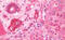 Interleukin 3 Receptor Subunit Alpha antibody, MBS249024, MyBioSource, Immunohistochemistry frozen image 