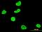 Serum/Glucocorticoid Regulated Kinase 1 antibody, orb94761, Biorbyt, Immunocytochemistry image 