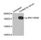 Insulin Receptor Substrate 1 antibody, STJ22198, St John
