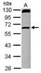 RCC1 And BTB Domain Containing Protein 1 antibody, GTX116303, GeneTex, Western Blot image 