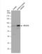 IKAROS Family Zinc Finger 2 antibody, NBP2-16802, Novus Biologicals, Western Blot image 