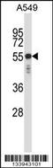 Keratin, type II cytoskeletal 6C antibody, 57-552, ProSci, Western Blot image 