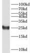 Protein Phosphatase 1 Regulatory Inhibitor Subunit 14D antibody, FNab06704, FineTest, Western Blot image 