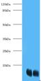 Fatty Acid Binding Protein 1 antibody, LS-B13806, Lifespan Biosciences, Western Blot image 