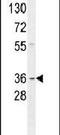 G Protein Subunit Alpha Transducin 3 antibody, PA5-23986, Invitrogen Antibodies, Western Blot image 