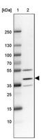 Transmembrane Protein 116 antibody, PA5-59266, Invitrogen Antibodies, Western Blot image 