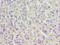 Acid Phosphatase 1 antibody, LS-C375130, Lifespan Biosciences, Immunohistochemistry frozen image 