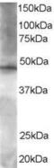 BRF2 RNA Polymerase III Transcription Initiation Factor Subunit antibody, PA5-18101, Invitrogen Antibodies, Western Blot image 