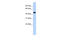 Creatine Kinase, M-Type antibody, 25-701, ProSci, Western Blot image 