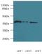 Aspartate Beta-Hydroxylase Domain Containing 2 antibody, A58194-100, Epigentek, Western Blot image 