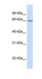 Carbohydrate Sulfotransferase 15 antibody, orb325320, Biorbyt, Western Blot image 