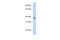 Solute Carrier Family 25 Member 42 antibody, 25-934, ProSci, Western Blot image 