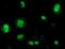 Beta-Transducin Repeat Containing E3 Ubiquitin Protein Ligase antibody, NBP2-03654, Novus Biologicals, Immunocytochemistry image 