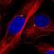 Centrosomal Protein 350 antibody, NBP2-59028, Novus Biologicals, Immunocytochemistry image 