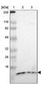 Translocase Of Inner Mitochondrial Membrane 8A antibody, PA5-51977, Invitrogen Antibodies, Western Blot image 