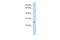 Ferritin Heavy Chain Like 17 antibody, A17162, Boster Biological Technology, Western Blot image 