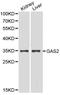Growth Arrest Specific 2 antibody, LS-C192375, Lifespan Biosciences, Western Blot image 