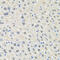 Solute Carrier Family 3 Member 2 antibody, 19-804, ProSci, Immunohistochemistry paraffin image 
