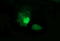 Mitogen-Activated Protein Kinase 13 antibody, LS-C787867, Lifespan Biosciences, Immunofluorescence image 