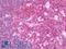 RELT TNF Receptor antibody, LS-B11459, Lifespan Biosciences, Immunohistochemistry paraffin image 