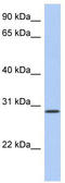 Hepatitis A Virus Cellular Receptor 2 antibody, TA337951, Origene, Western Blot image 