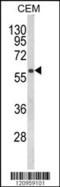 Folliculin antibody, 63-574, ProSci, Western Blot image 