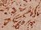 Keratin 16 antibody, A03393S451, Boster Biological Technology, Immunohistochemistry frozen image 