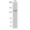 Colony Stimulating Factor 1 Receptor antibody, LS-C382688, Lifespan Biosciences, Western Blot image 