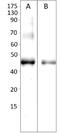 Alpha-Methylacyl-CoA Racemase antibody, GTX15894, GeneTex, Western Blot image 